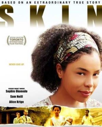 Kiközösítés – Skin (2008) 